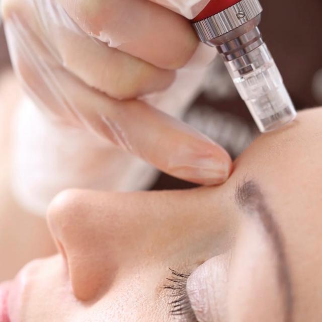 Microneedling package 